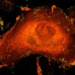Microscopy image of an infected cell