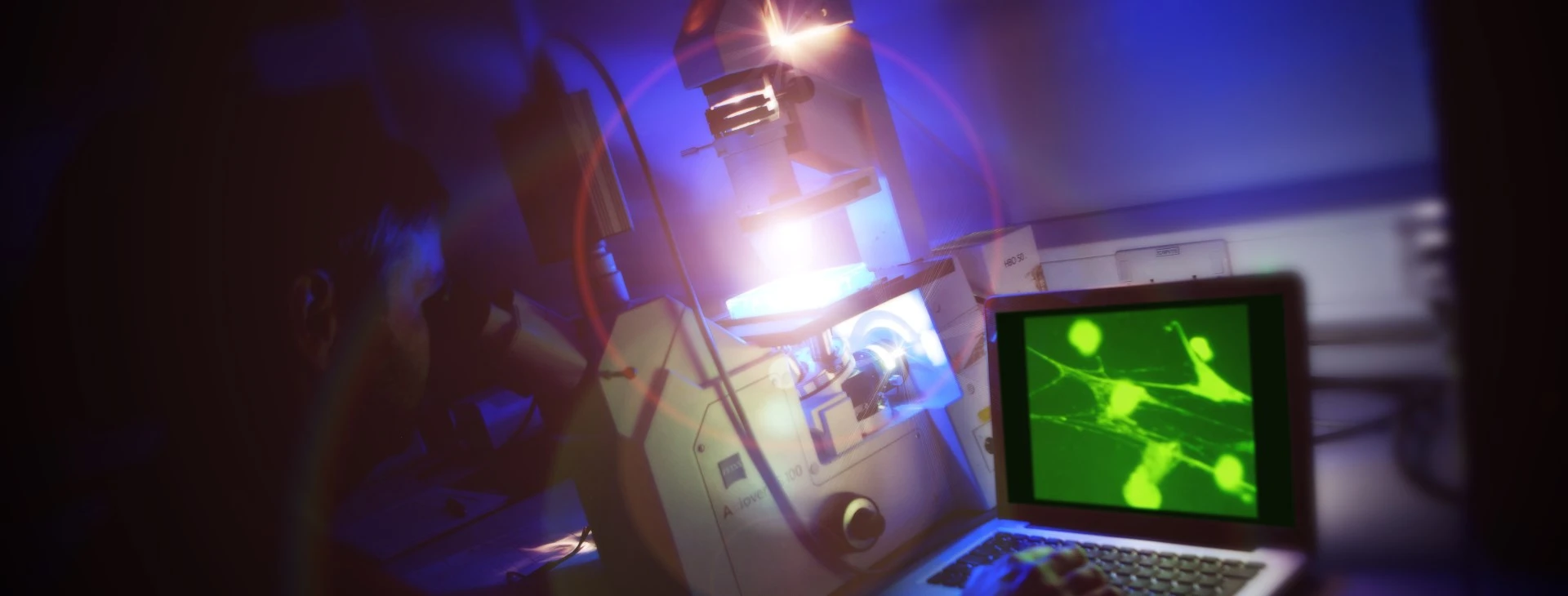 Micrscope and image of green fluorescently-labelled cells on the screen
